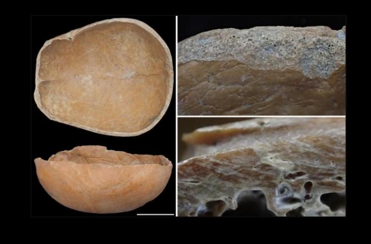 Cangkir tengkorak (Tipe A). Skala batang 5 cm. [nature.com]